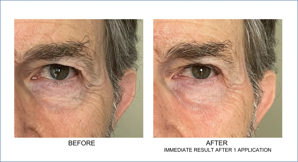 Orlane Paris - Anti-Fatigue Contour Des Yeux