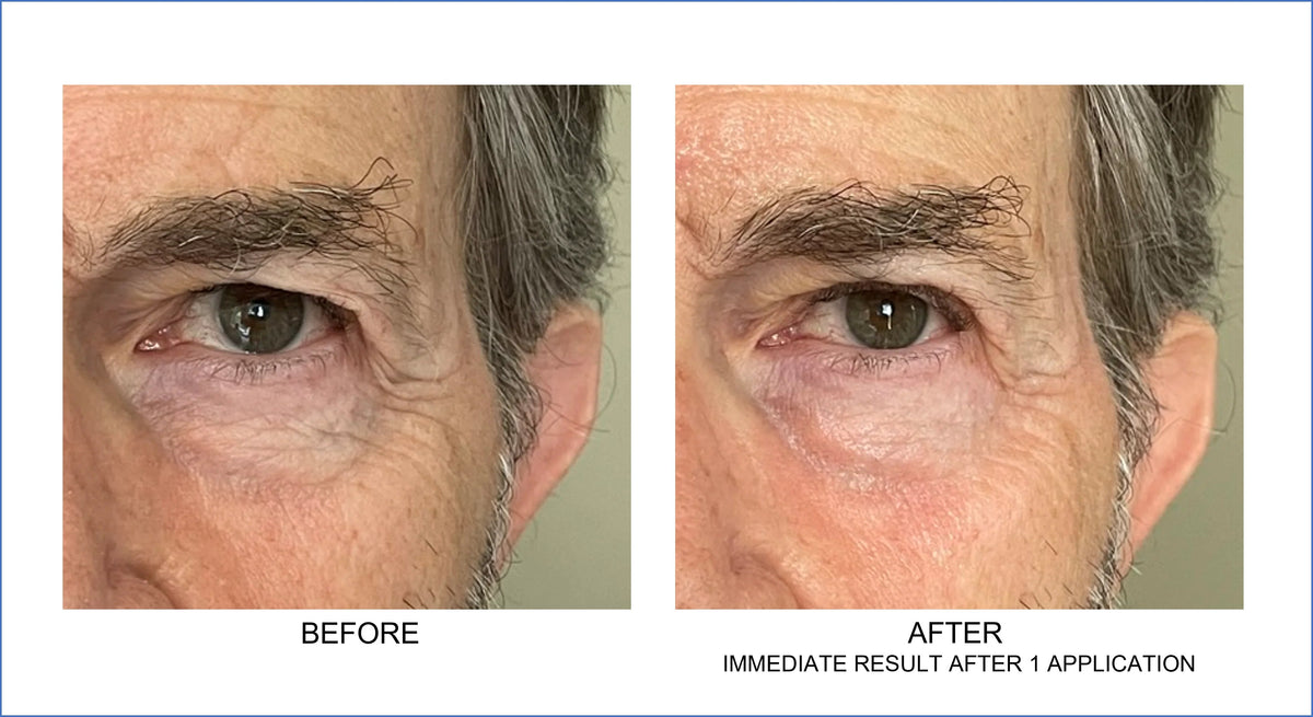 Orlane Paris - Anti-Fatigue Contour Des Yeux
